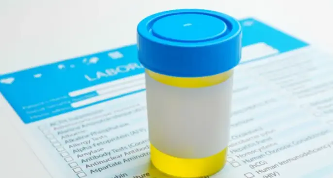 How Is Urine Formed in the Body_ How Is Urine Formed in the Body?